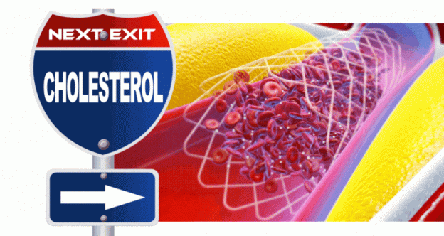 Lower Your Risk, Boost Your Health: All About Cholesterol 